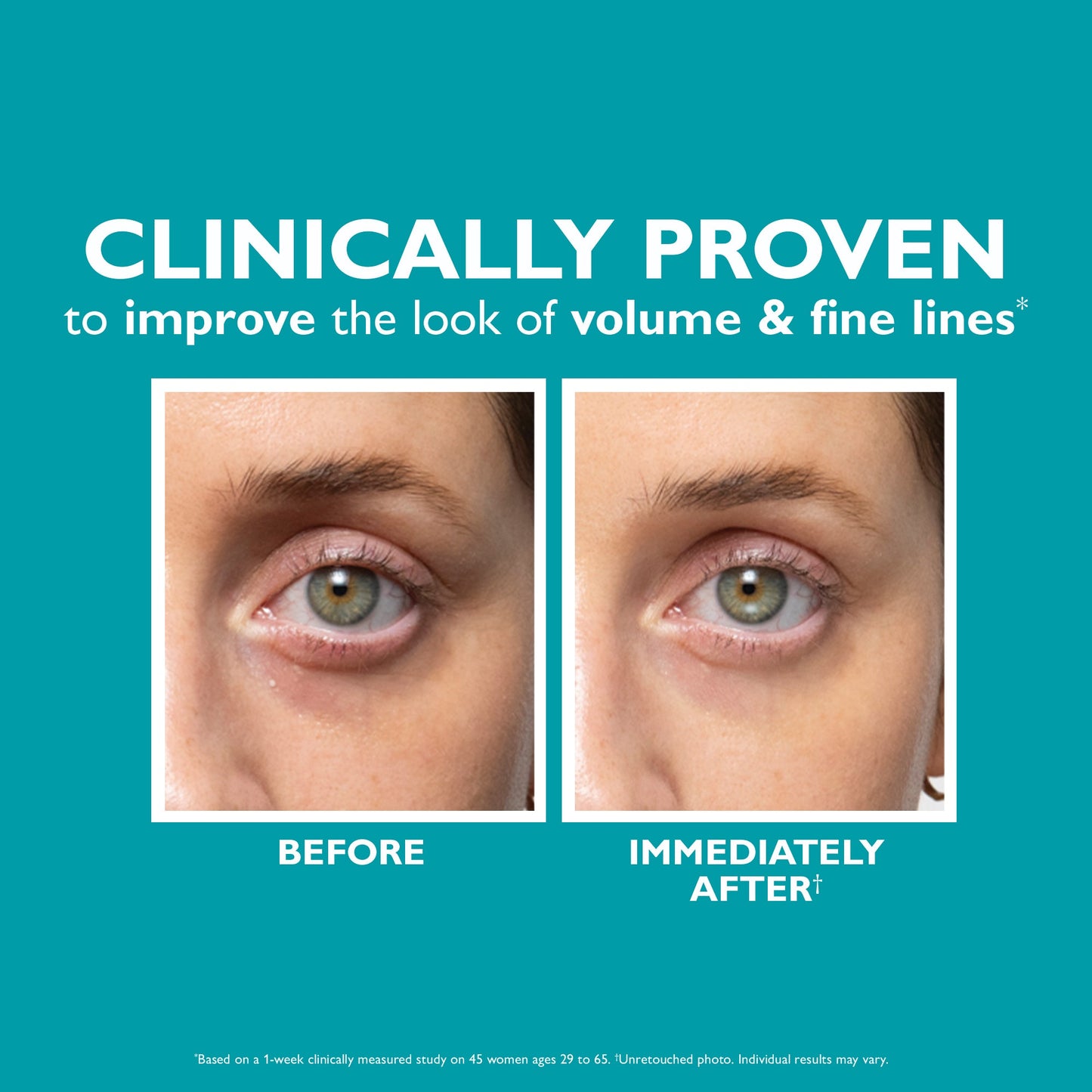 Peptide Skinjection™ Fill + Fix Under-Eye Cream